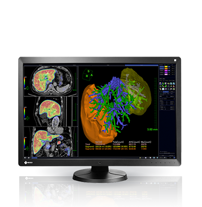 EIZO  Monitores para Oficina, Fotografía y Diseño, Medicina